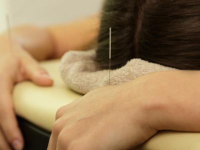 Séance d'acupuncture, gros plan sur les mains d'une personne couchée avec une aiguille dans chaque main.