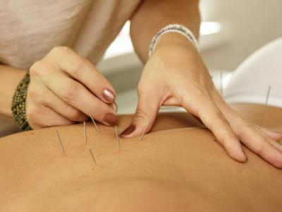 Personne en pleine séance d'acupuncture.