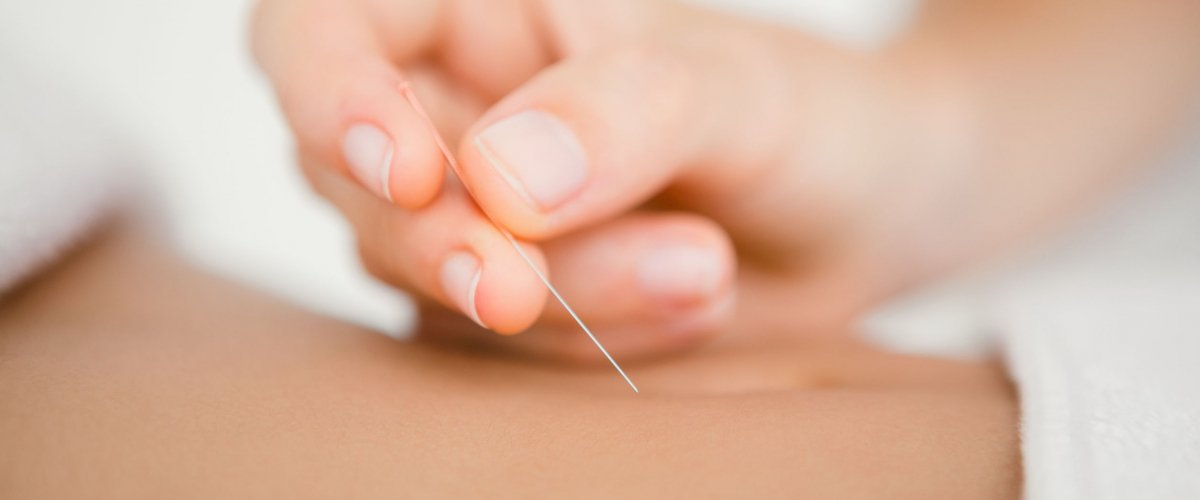 Photo d'un séance d'acupuncture montrant une aiguille sur le point d'être piquée dans la zone ventrale.